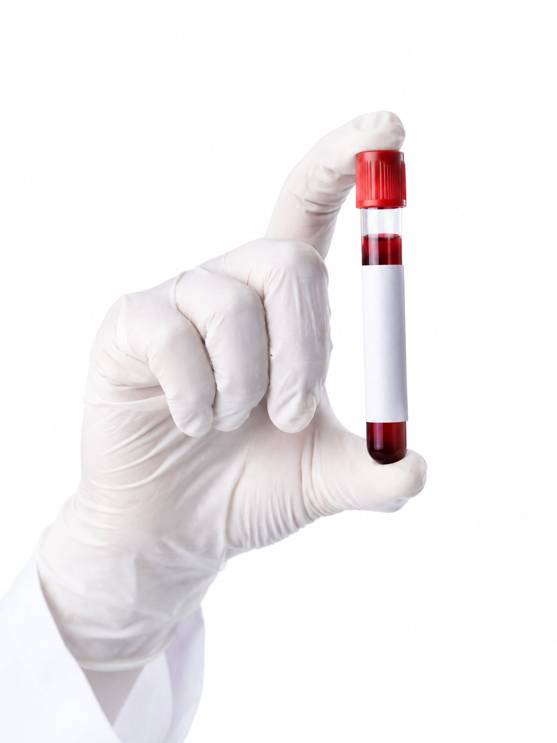 Lab Test